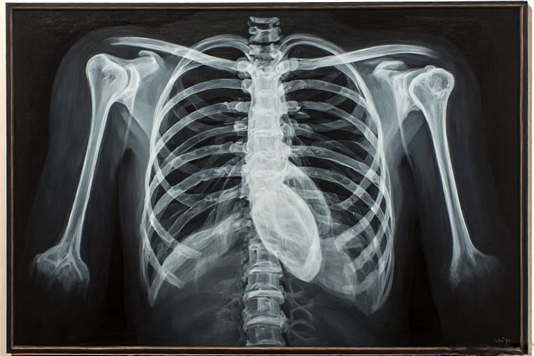 Discovery of X-rays, Germany | 1895-11-08